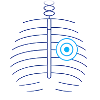 Core